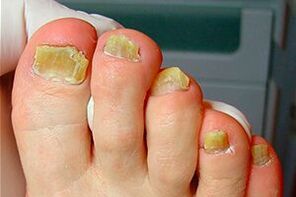Nails