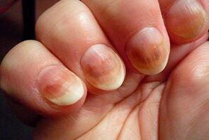 nails