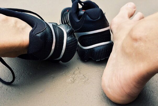Causes of the appearance of mycosis of the feet