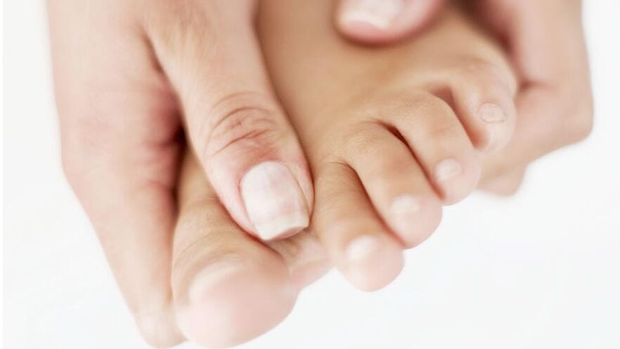 itching due to nail fungus on the thumb