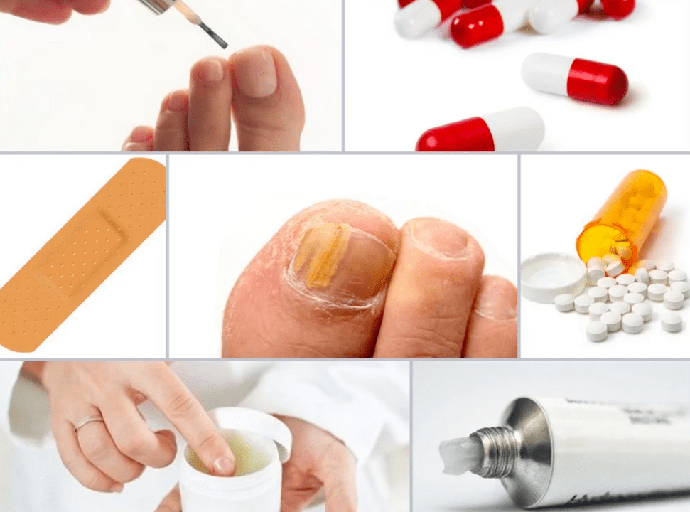 systemic remedies for toenail fungus
